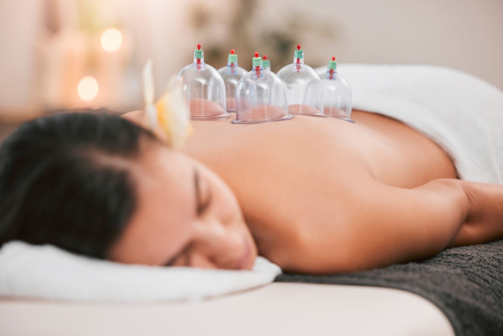 Guest resting on a massage table with cups placed along her upper back